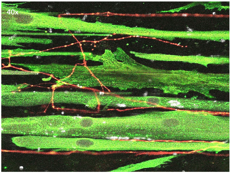 在20倍放大图中，白色小点表示后突触的乙酰胆碱受体α-毒蛇毒素，显示了肌肉和运动神经元的关键功能性神经支配，并且具有功能性的乙酰胆碱神经肌肉接头（NMJ）突触