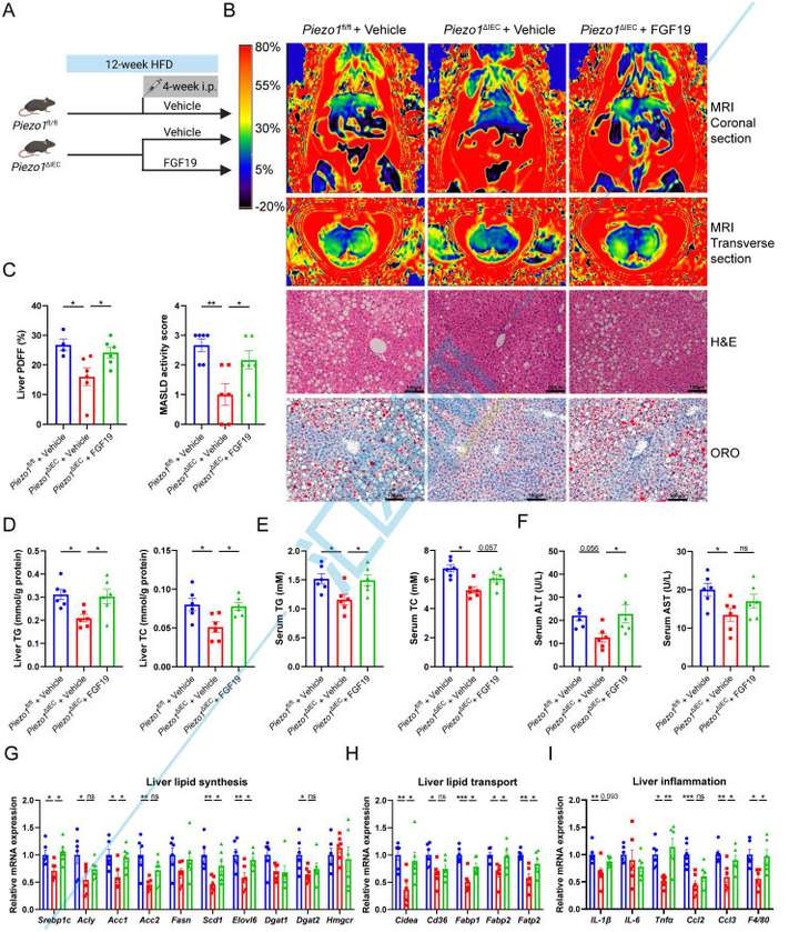 期刊飞升，10分一区Top再收Piezo1！微生物组+转录组+代谢组+类器官，武汉协和医院研究团队为代谢性疾病研究提供新范本~