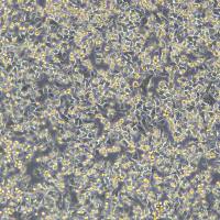 浙江（杭州）美森 乳头状甲状腺癌细胞 IHH4