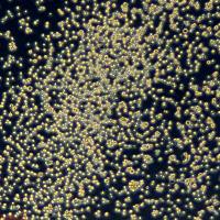 人弥漫性大B细胞淋巴瘤细胞 SU-DHL-6