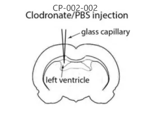 小胶质细胞清除解决方案方法学对比知多少？