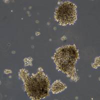 浙江(杭州)美森 人弥漫大B细胞淋巴瘤细胞 OCI-LY3