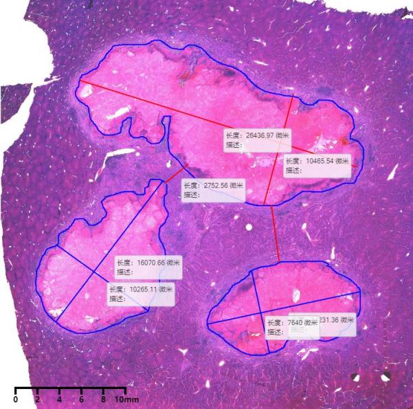 医疗器械产品开发安全性评价——病理学评价