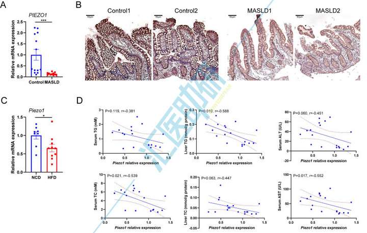 期刊飞升，10分一区Top再收Piezo1！微生物组+转录组+代谢组+类器官，武汉协和医院研究团队为代谢性疾病研究提供新范本~