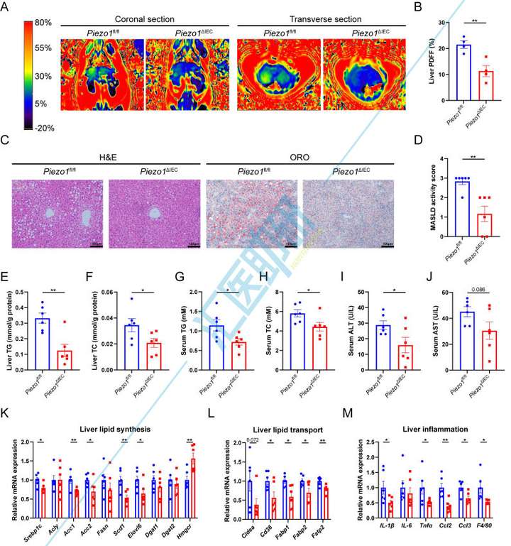 期刊飞升，10分一区Top再收Piezo1！微生物组+转录组+代谢组+类器官，武汉协和医院研究团队为代谢性疾病研究提供新范本~