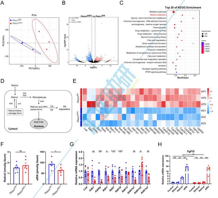 期刊飞升，10分一区Top再收Piezo1！微生物组+转录组+代谢组+类器官，武汉协和医院研究团队为代谢性疾病研究提供新范本~