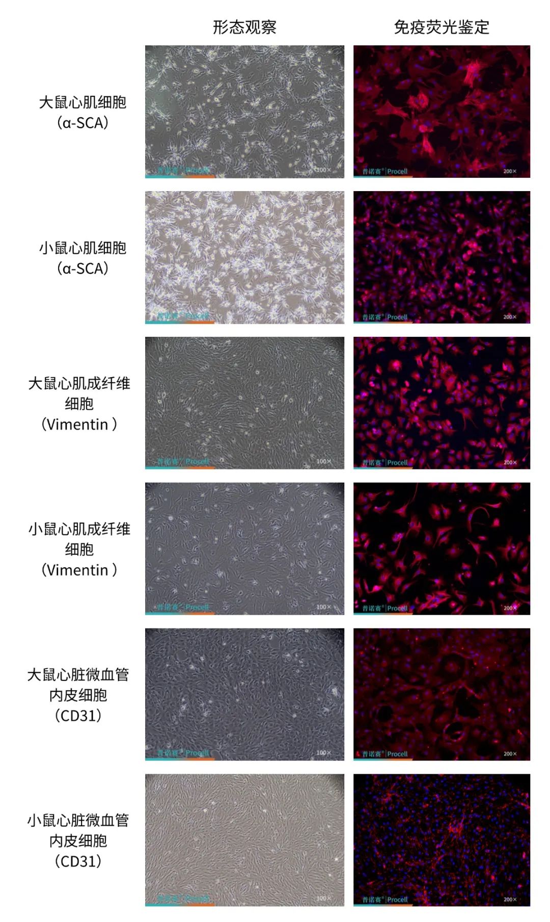 普诺赛®心脏类原代细胞分离培养试剂盒——告别心脏细胞分离难题！轻松Get高纯度心肌及相关细胞！