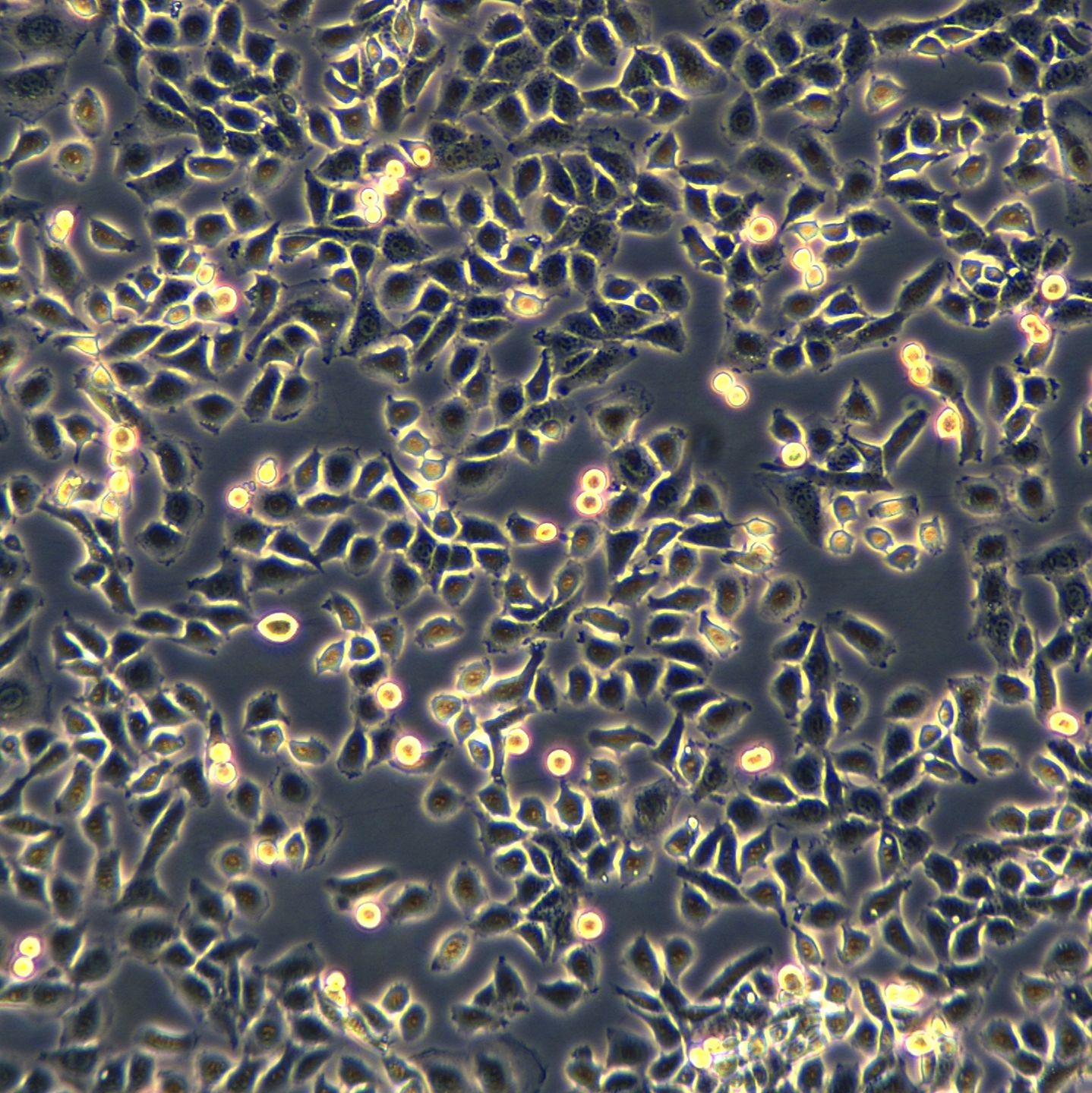 浙江（杭州）美森  小鼠乳腺癌细胞 EMT6