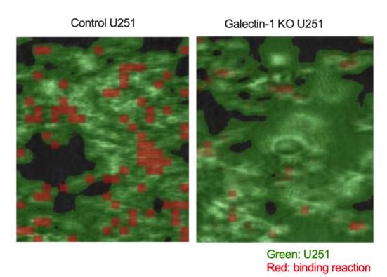 SPRM 200:生物医学研究的“超级显微镜”