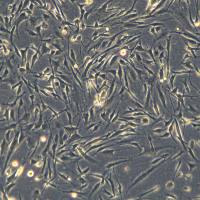 人淋巴管内皮细胞永生化 Immortal human lymphatic endothelial cells