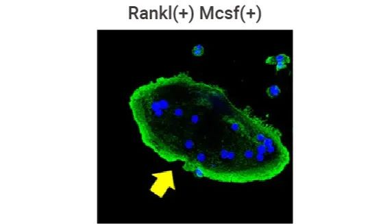 实验操作 | 破骨细胞的体外诱导! 攻略来咯~