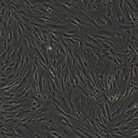 人原代皮肤成纤维细胞