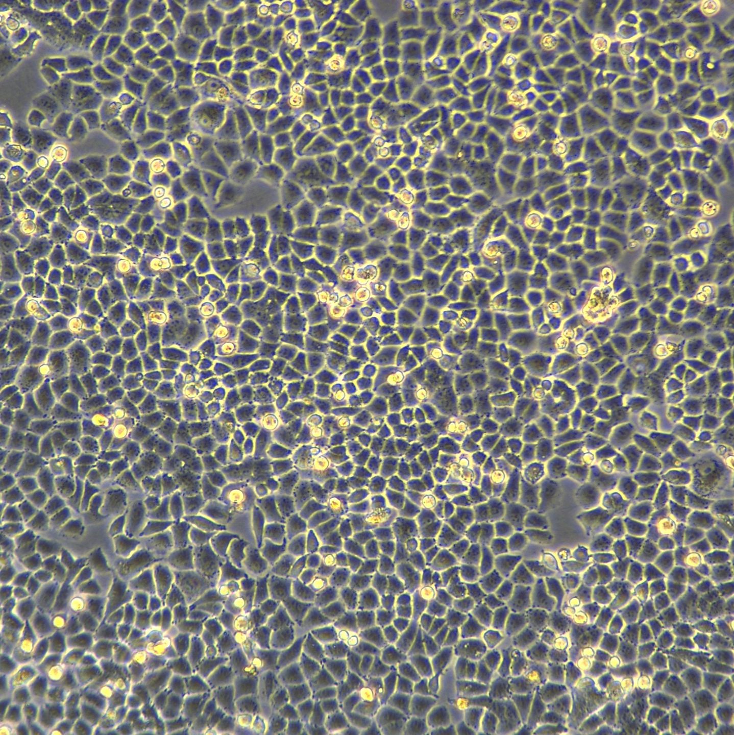 浙江（杭州）美森  人正常卵巢上皮细胞IOSE-80