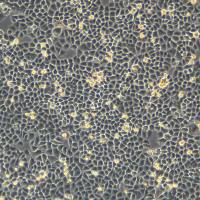 浙江（杭州）美森  人正常卵巢上皮细胞IOSE-80