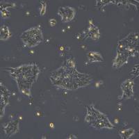 浙江（杭州）美森 人舌鳞癌细胞 UPCI-SCC-154