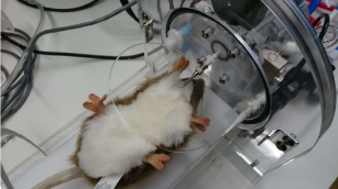 肺功能检测服务