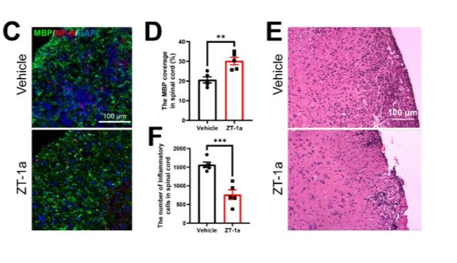 动物造模专题：EAE造模无症状？这些细节您必须知道