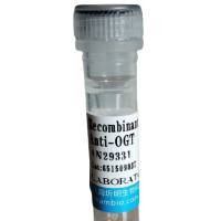 TP53诱导糖酵解凋亡调节蛋白(TIGAR)活性蛋白,人