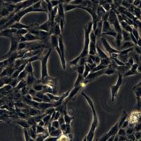 浙江(杭州)美森人乳腺癌细胞 SUM159PT