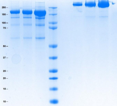 Athens-α2巨球蛋白 (A2M)，品质与价格的双重惊喜