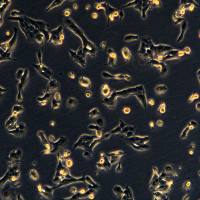 浙江（杭州）美森  人口腔鳞状细胞 WSU-HN30