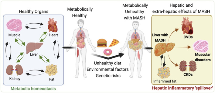 全球超1亿患者！MASH药物研发进展与核心模型解析