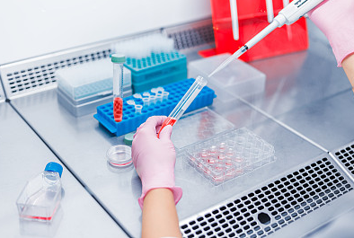 ELISA试剂盒实验中出现样本测值偏低的因素以及对应的解决方案