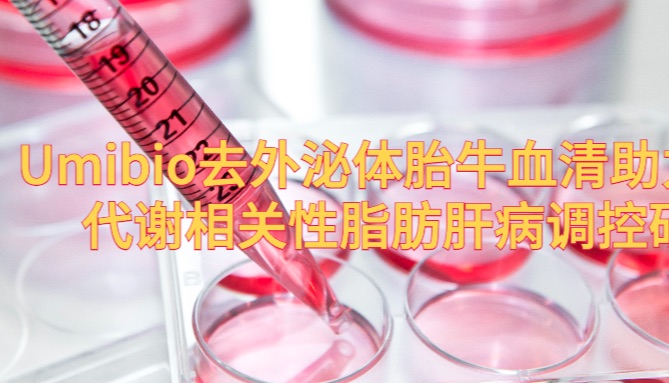 IF=33.2 | 揭示肠菌外泌体调控代谢相关性脂肪肝的机制