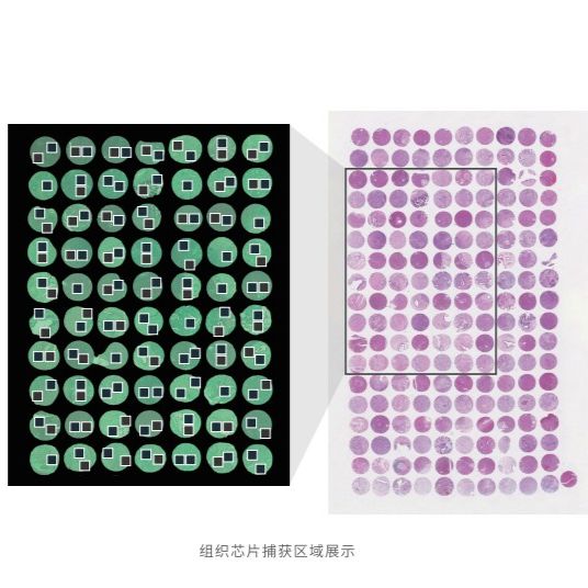 CosMx SMI 单细胞原位空间基因(蛋白)组检测技术
