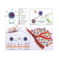 负载前药磷酸化卡泊三醇和多柔比星的热敏脂质体被靶向肽cRGDfK修饰 PCAL/DOX@liposome-cRGDfK