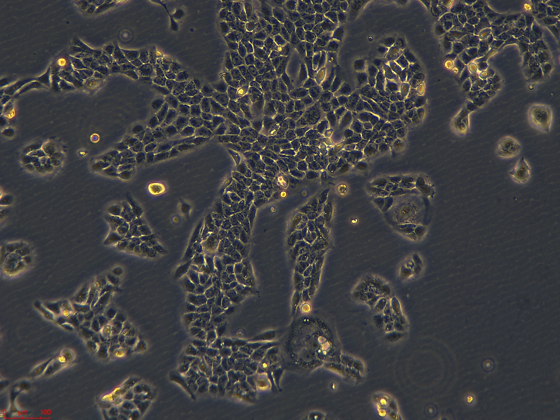 Project1002_HaCaT   10X_ch00.jpg