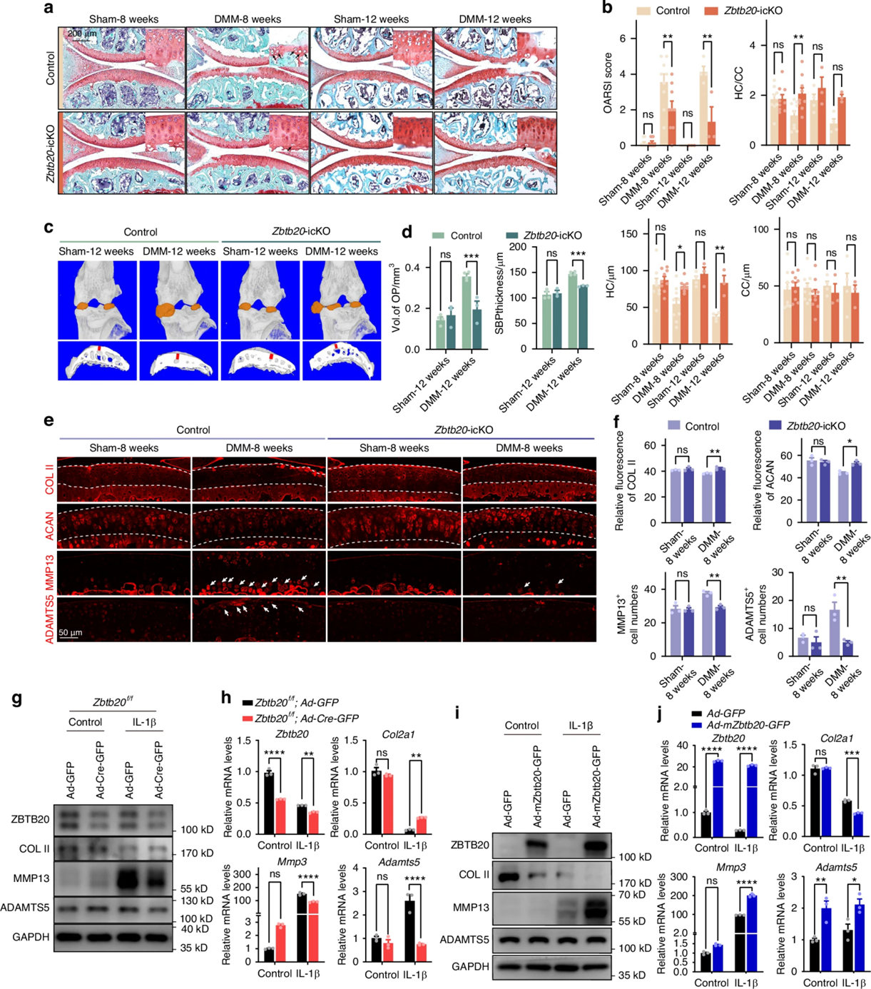 Bone Reaserch丨关节炎早期干预新策略——LATS1-ZBTB20轴如何成为软骨救星