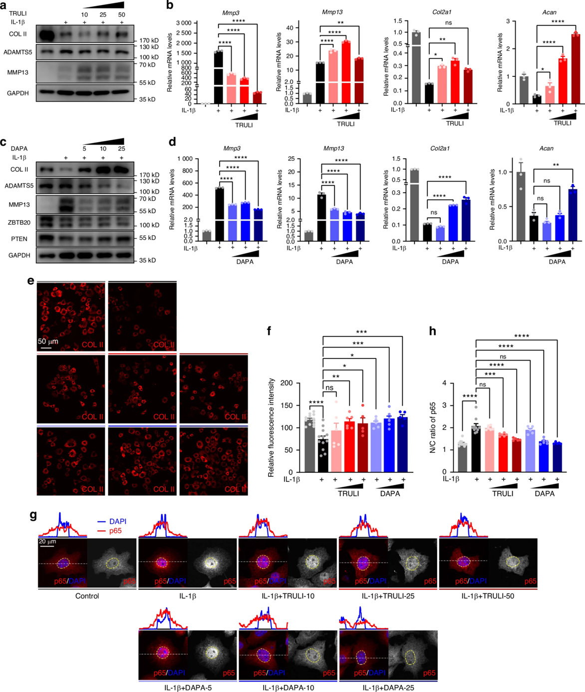 Bone Reaserch丨关节炎早期干预新策略——LATS1-ZBTB20轴如何成为软骨救星