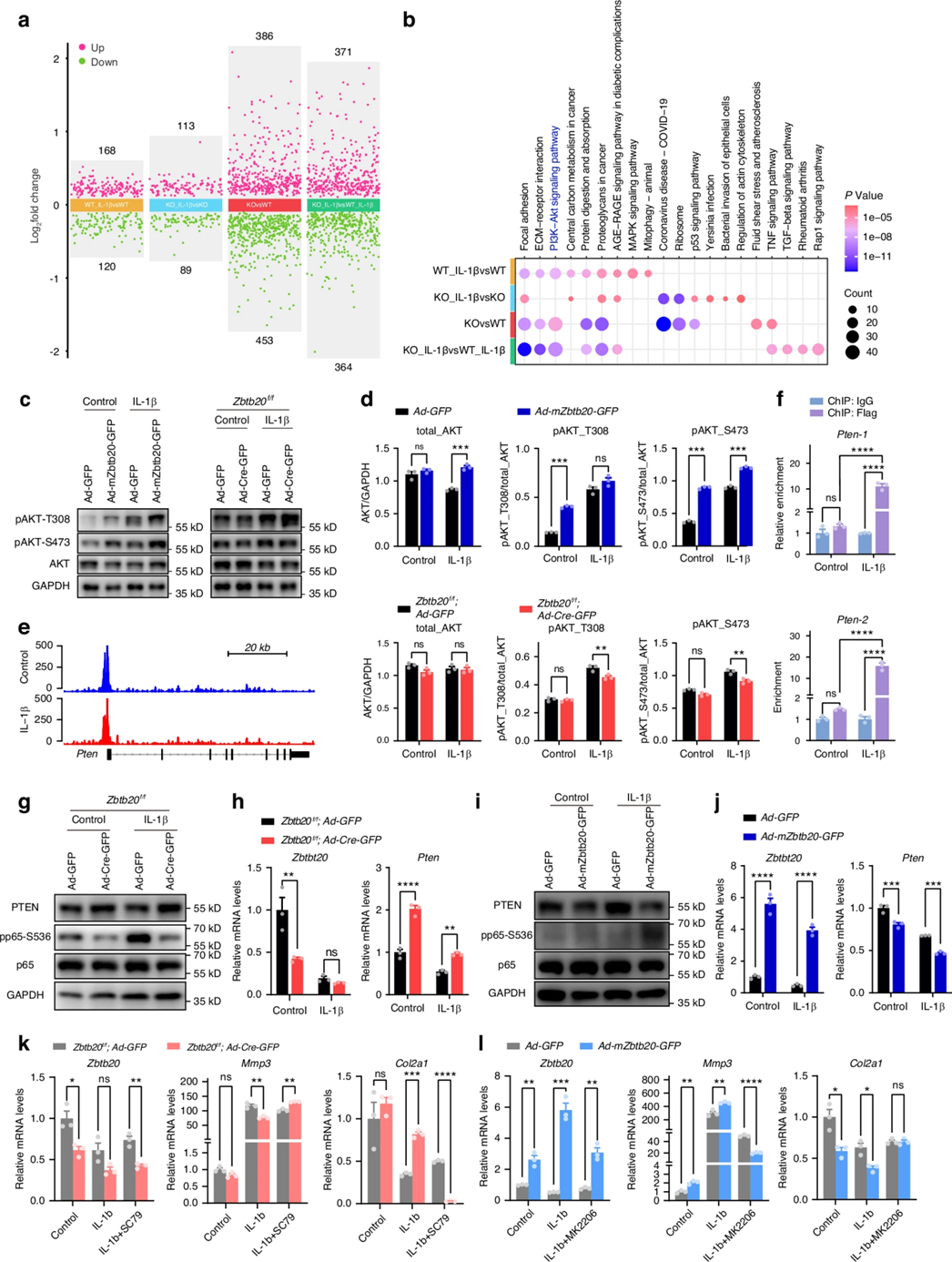 Bone Reaserch丨关节炎早期干预新策略——LATS1-ZBTB20轴如何成为软骨救星