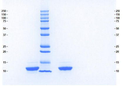 Athens-载脂蛋白CIII，品质与优惠并存！