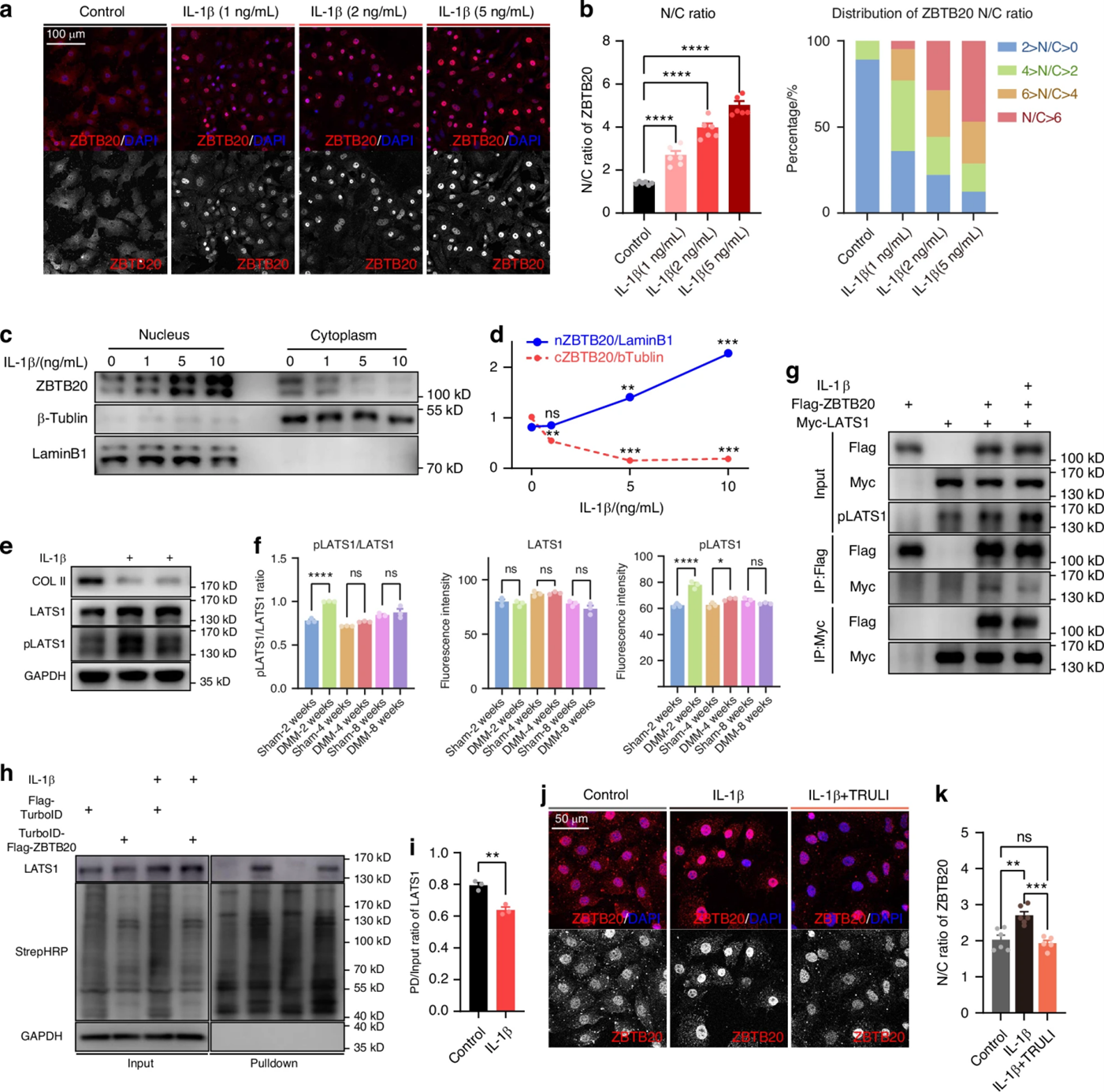Bone Reaserch丨关节炎早期干预新策略——LATS1-ZBTB20轴如何成为软骨救星