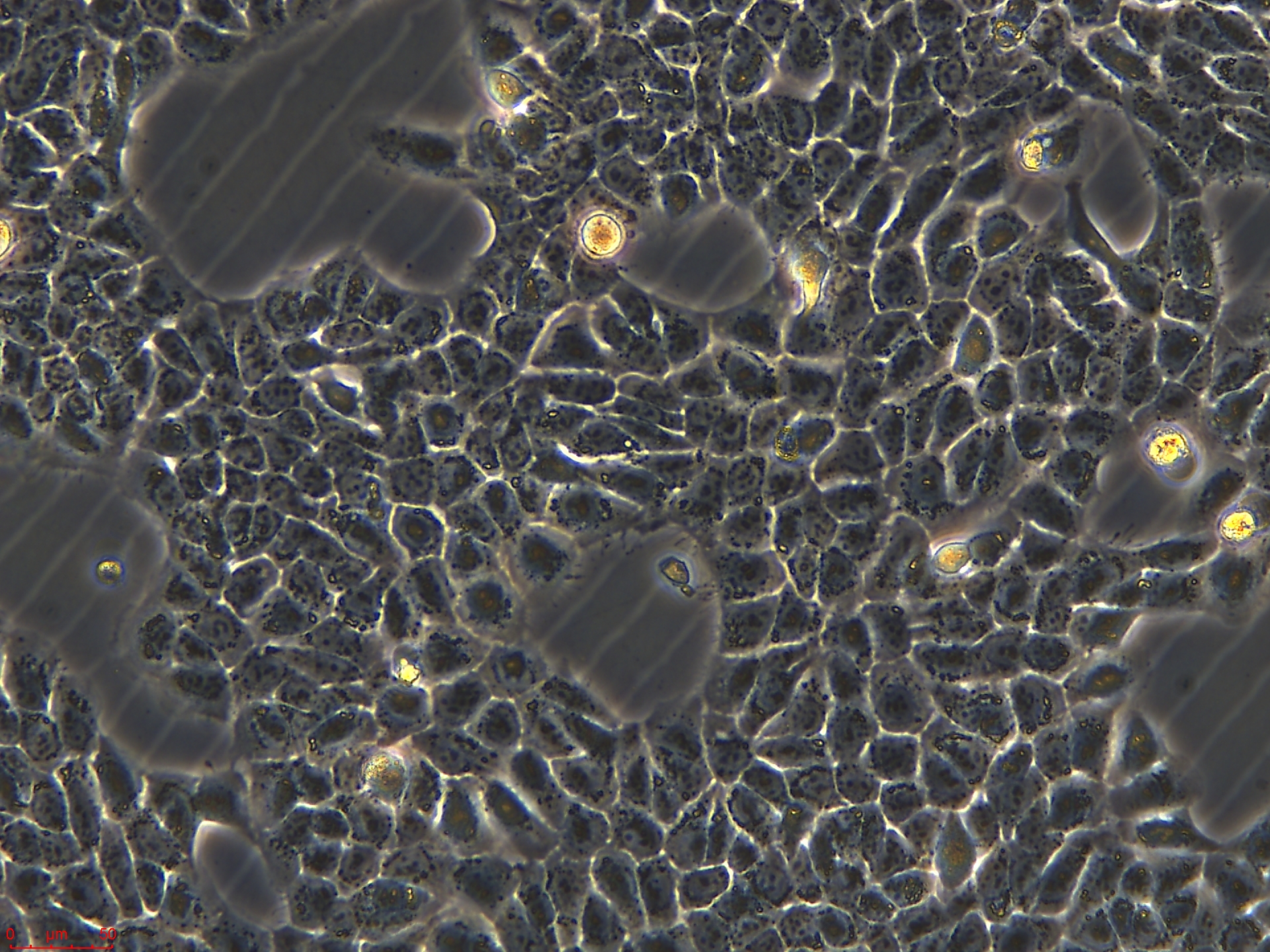 Project1002_HaCaT   20X_ch00.jpg