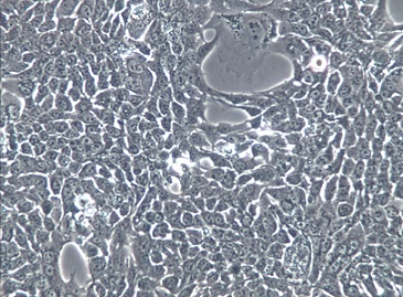 HCC827人非小细胞肺癌细胞