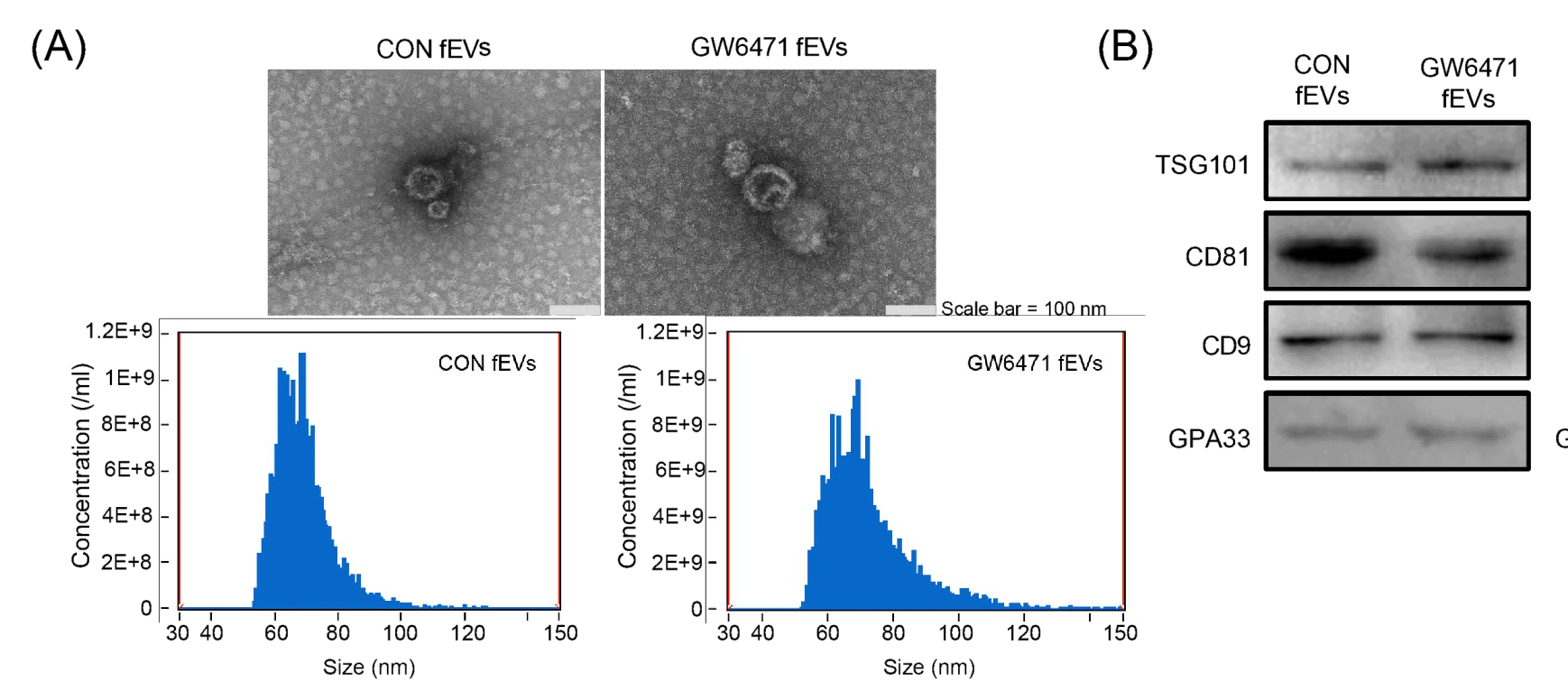 IF=33.2 | 揭示肠菌外泌体调控代谢相关性脂肪肝的机制