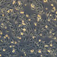 浙江(杭州)美森 人肺腺癌细胞奥西替尼耐药株NCI-H1975/Osimertinib