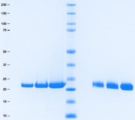Athens-C反应蛋白(CRP)限时开启，速抢！