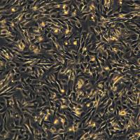 浙江（杭州）美森 正常人小肠上皮细胞 HIEC-6