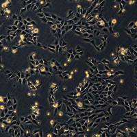 浙江（杭州）美森 人骨肉瘤细胞 143B