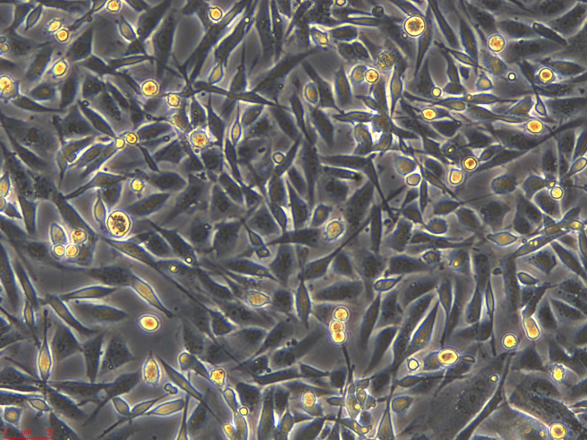 20230519_MDA-MB-231   20X_ch00.jpg