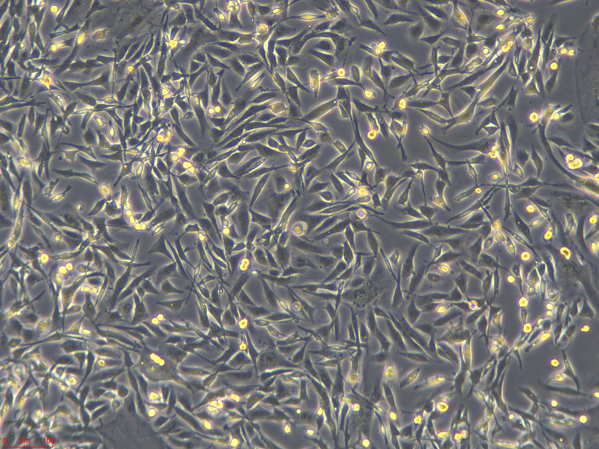 20230519_MDA-MB-231   10X_ch00.jpg