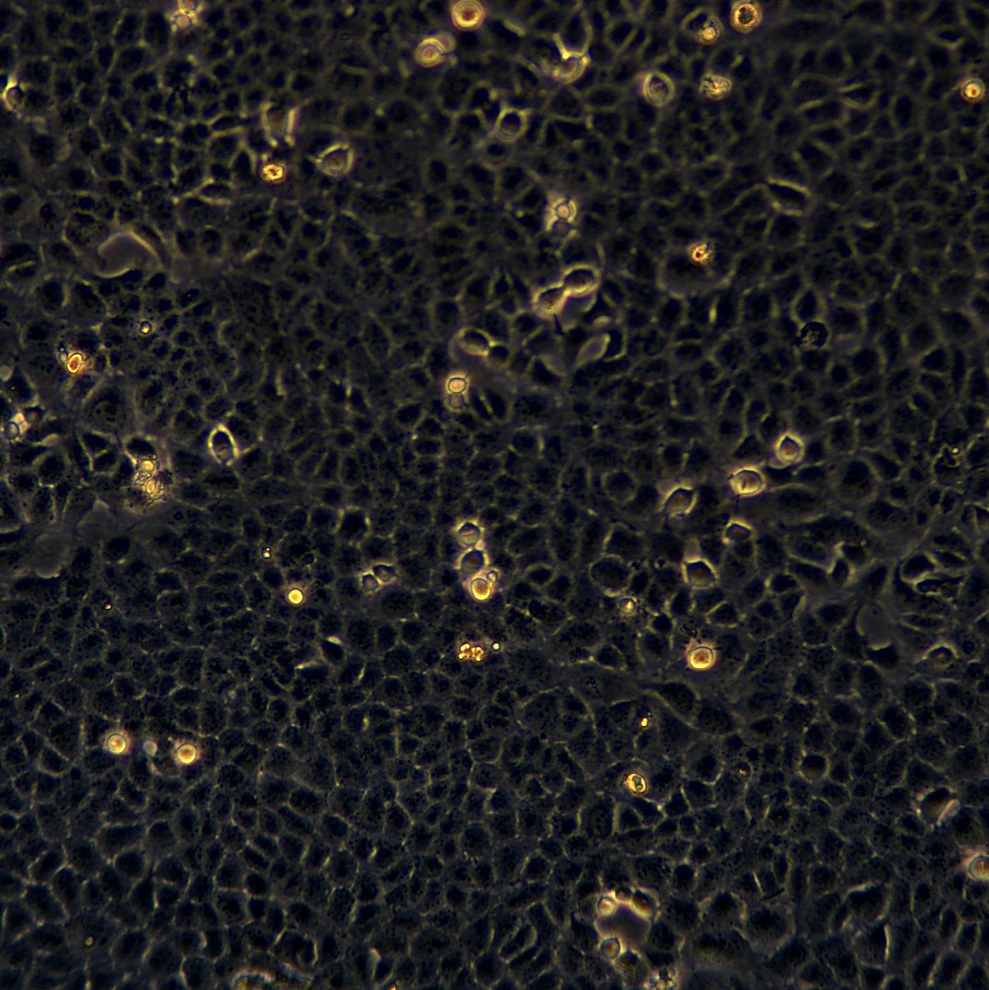 浙江（杭州）美森 人胎盘滋养细胞 HTR-8-SVneo