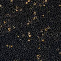 浙江（杭州）美森 人胎盘滋养细胞 HTR-8-SVneo