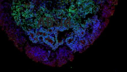 IPS诱导内耳类器官培养攻略