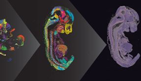 1+1＞2，Trekker探秘“单细胞+空间转录组技术”