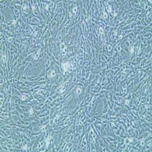 小鼠小肠平滑肌细胞永生化